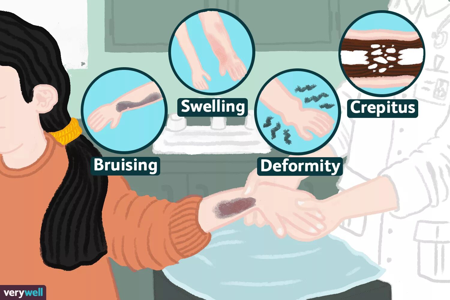 A fracture is a broken bone. How many people suffer from broken bones?. swelling bruising after implantology.