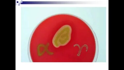 Streptococcus spp