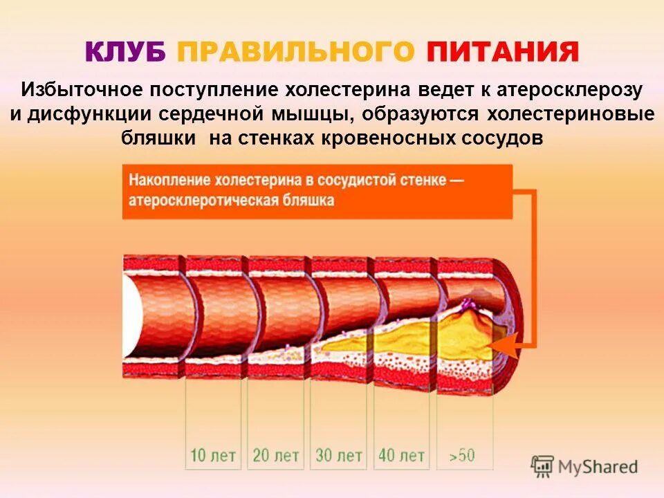 Лишний холестерин. Ожирение и атеросклероз. Холестерин в мышечной ткани. Избыточного поступления холестеринов.