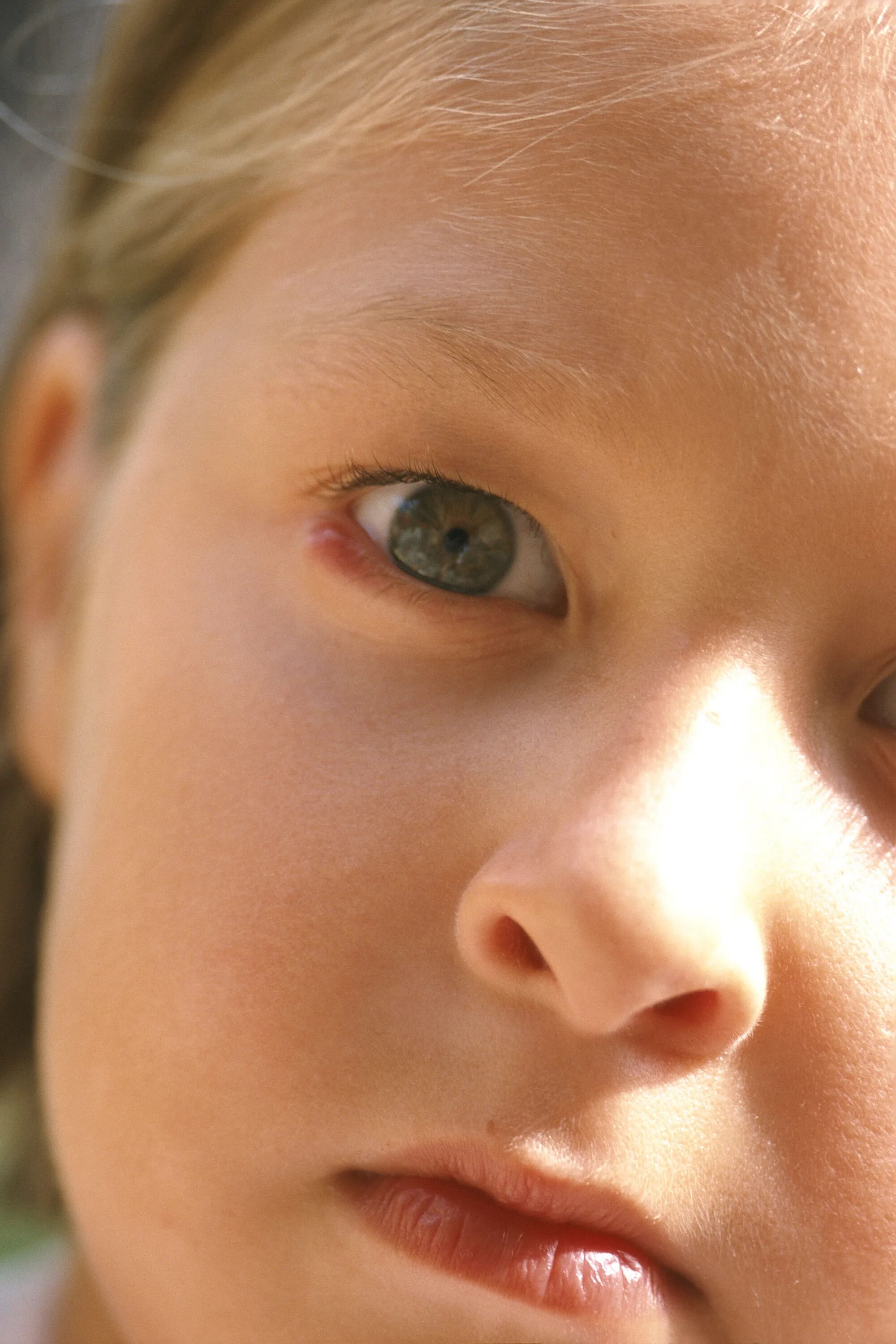 ячмень ребенок 4 года