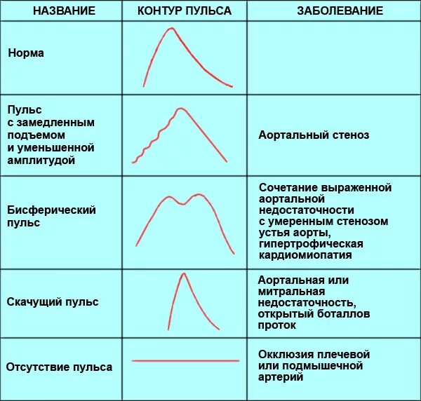 Сердцебиение болезнь. Форма пульсовой волны при недостаточности аортального клапана. Виды пульсовой волны. Пульс при аортальной недостаточности. Основные параметры пульса.