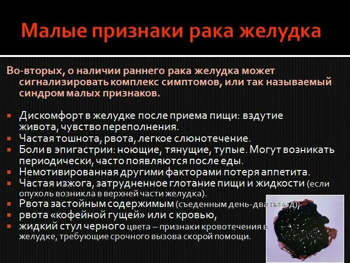 Проявление рака желудка