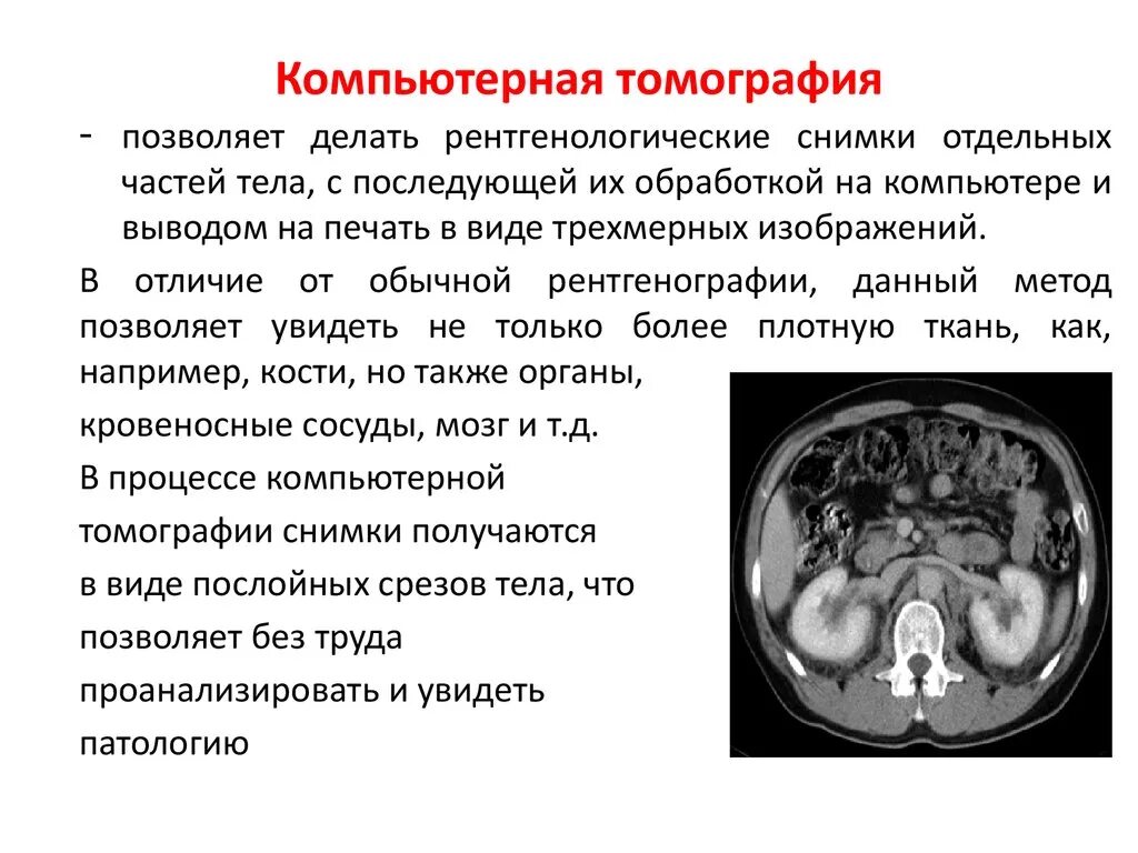 Можно по кт определить. Разновидности компьютерной томографии. Количественная компьютерная томография. Компьютерная томография позволяет. Виды кт исследований.