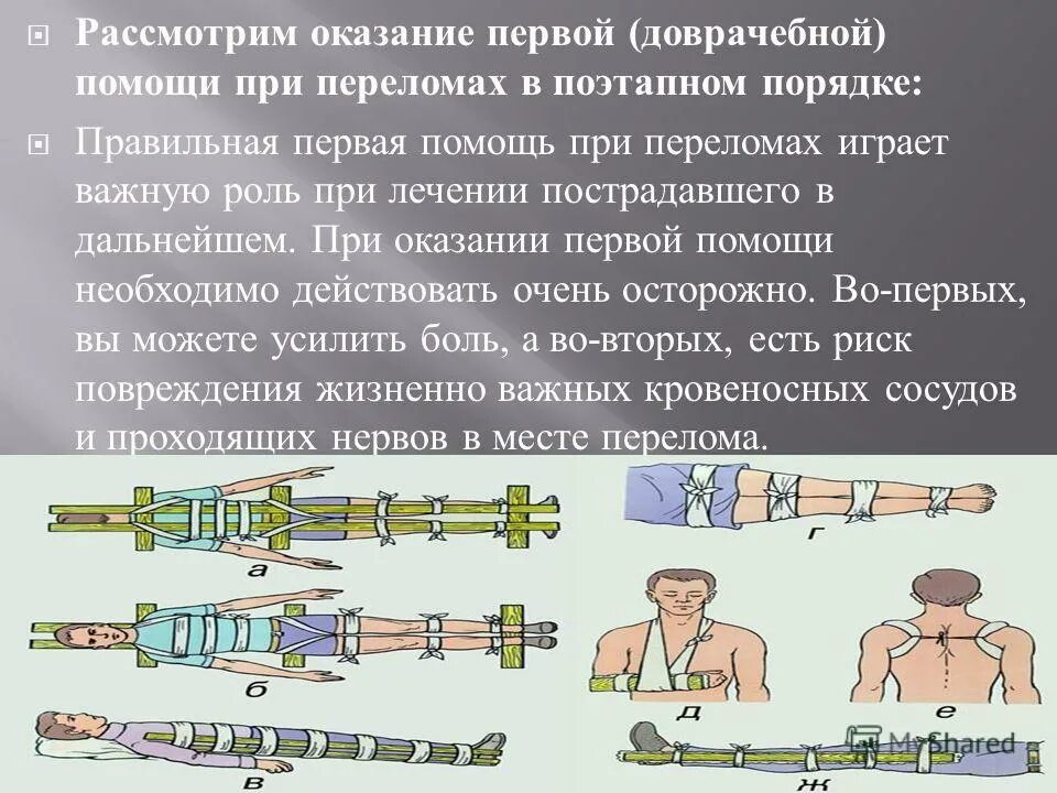 Основная первая помощь при переломах