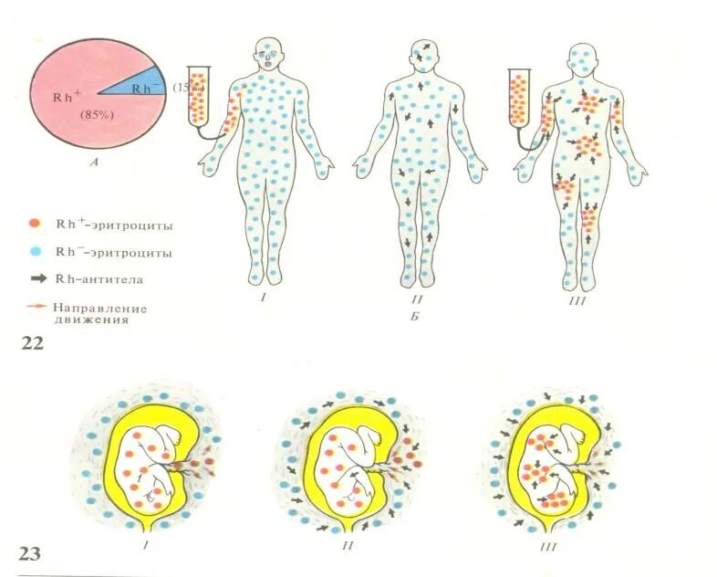 Резус фактор просто. Резус фактор. Резус фактор физиология. Резус фактор крови физиология. Резус конфликт арт.