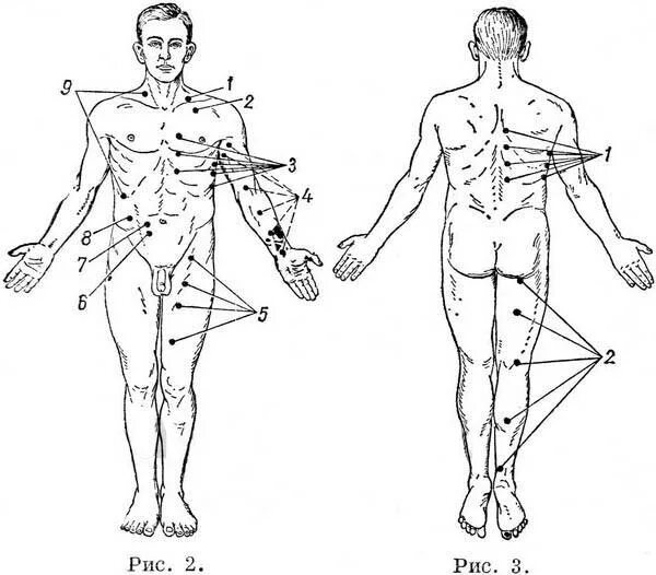 Точка спереди. Болевые точки. Точки тела человека. Болевые точки на теле человека. Болевые точки у человека на теле схема.