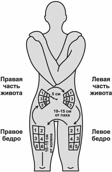 Укол в бедро схема. Место инъекции в бедро внутримышечно. Место уколов в бедро