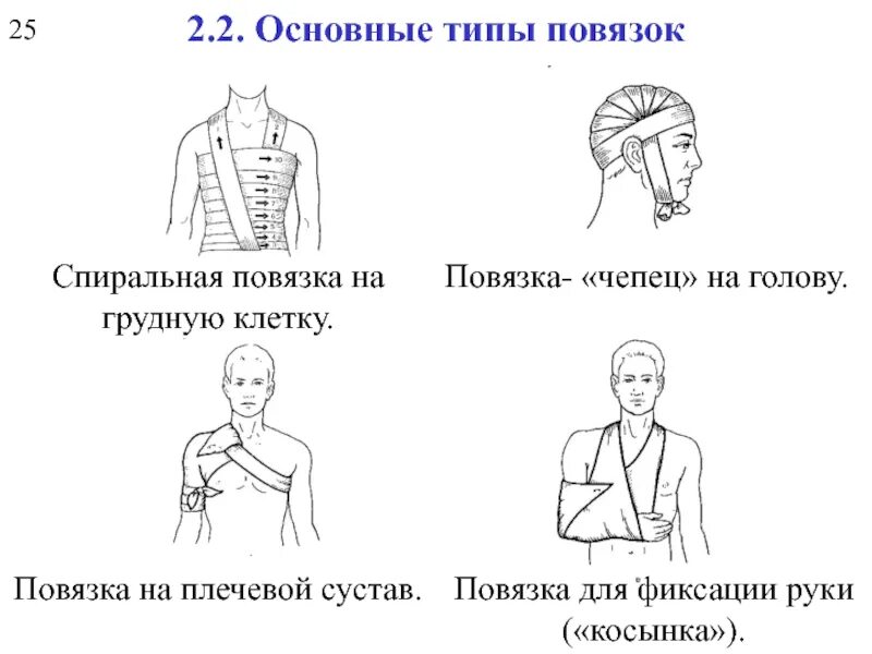 Основные типы повязок. Спиральная повязка на плечо. Спиральная повязка на плечевой сустав. Типы повязок на плечо. Спиральная повязка на голову.