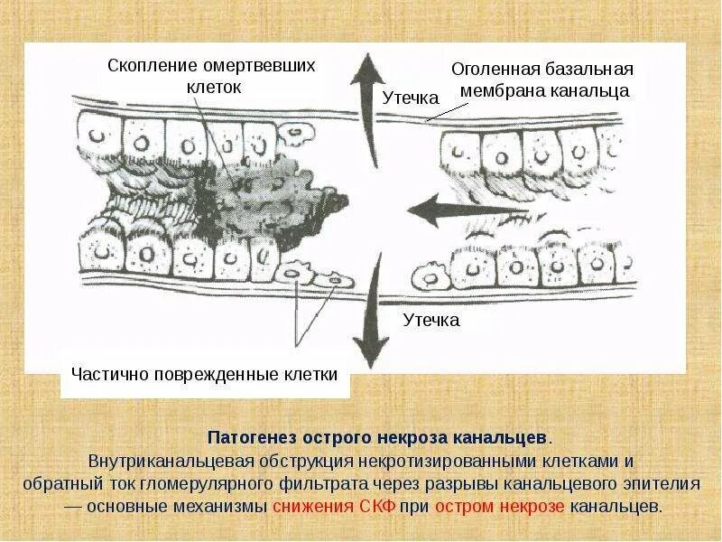 Базальная мембрана канальцев. Сустентоциты гистология. Функции поддерживающих клеток сустентоцитов семенника. Базальная мембрана канальцев. Базальная мембрана почечных канальцев.