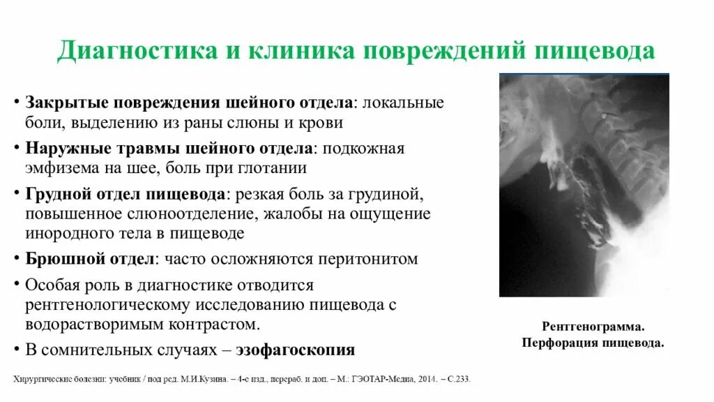 Пищевод боль в спине. При глотании пищи боль в грудной клетке посередине. Травма пищевода симптомы. Боль в грудной клетке при проглатывании пищи. Спонтанный разрыв пищевода.