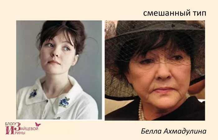 Тип старения примеры. Птозный тип старения. деформационный тип старения лица. смешанный тип старения лица. мускульный тип старения кожи.