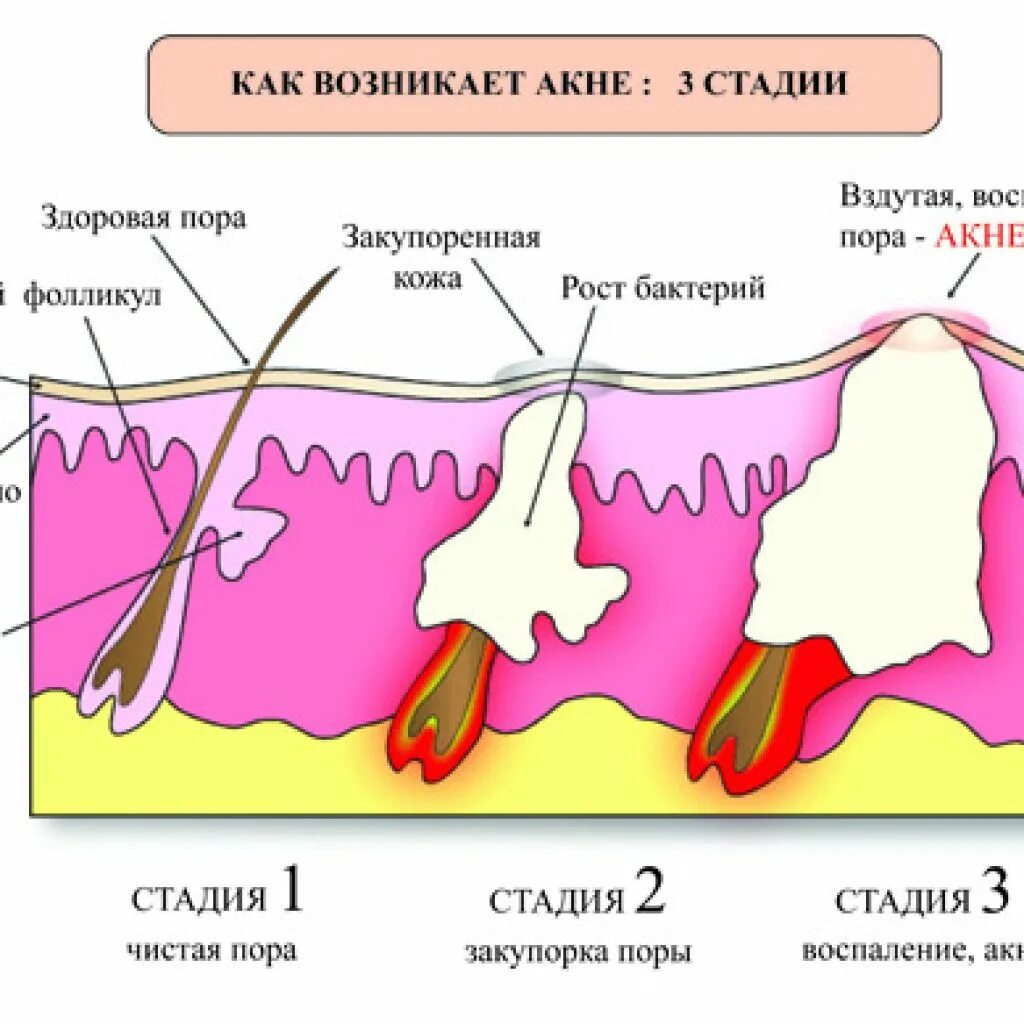 Почему появляются воспаления