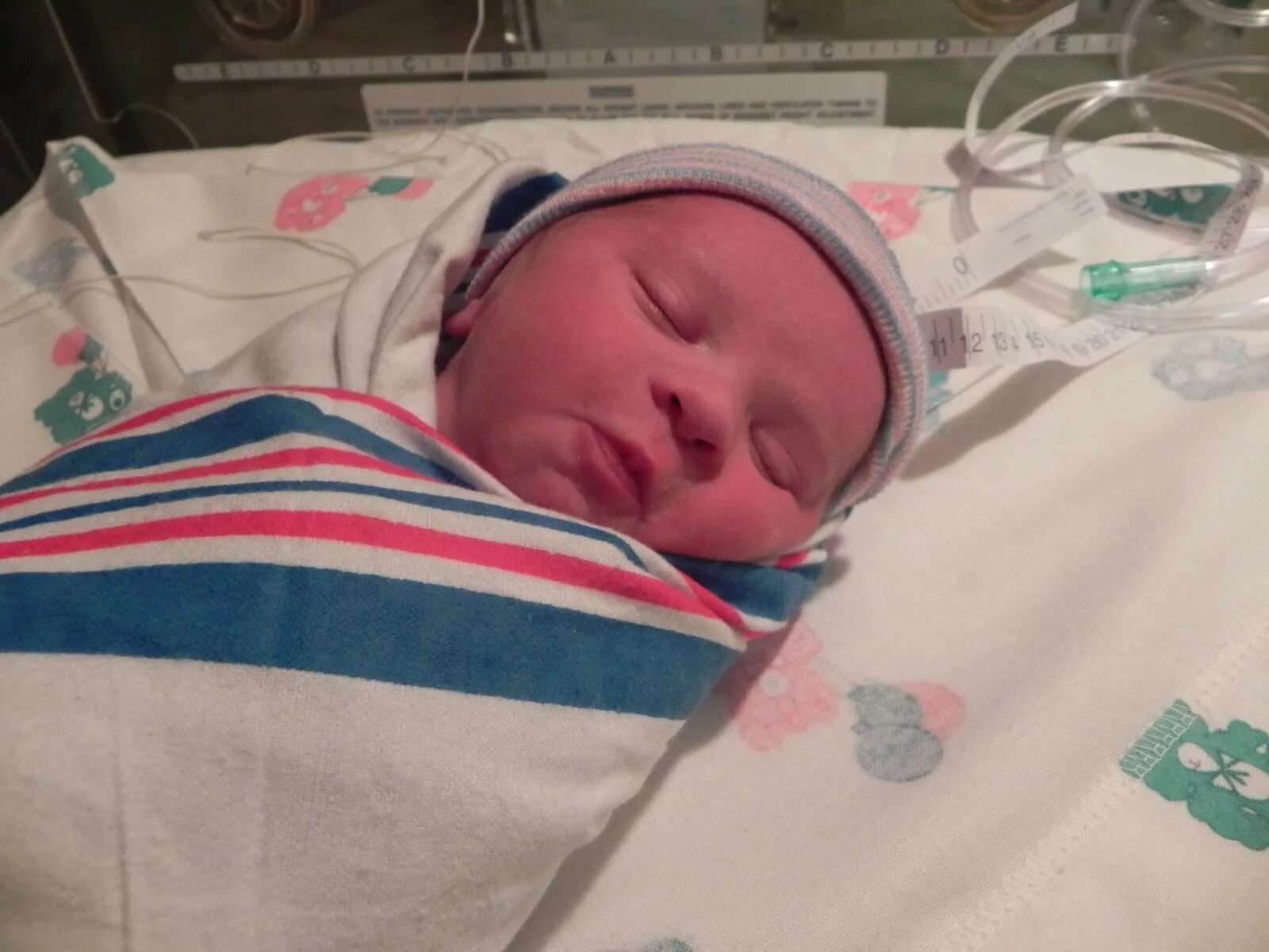 новорожденные дети дауны. синдром дауна в роддоме. новорожденные с синдромом дауна в роддоме. новорожденный ребенок. недоношенные дети с синдромом дауна.