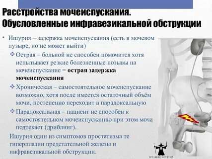 Лечение нарушения мочеиспускания