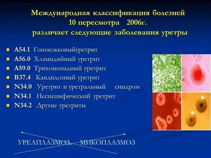 Выделения при уретрите