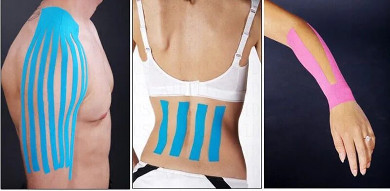 Тейпирование надколенника. Тейп лента кинезиологическая для коленного сустава. Кензо тейп. Пластырь при растяжении мышц. Пластырь при растяжении мышц.