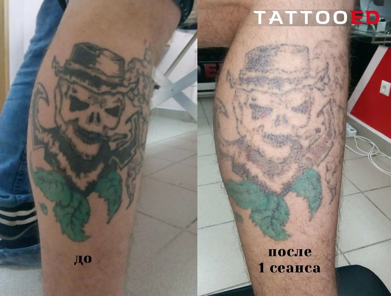 Как заживлять татуировку
