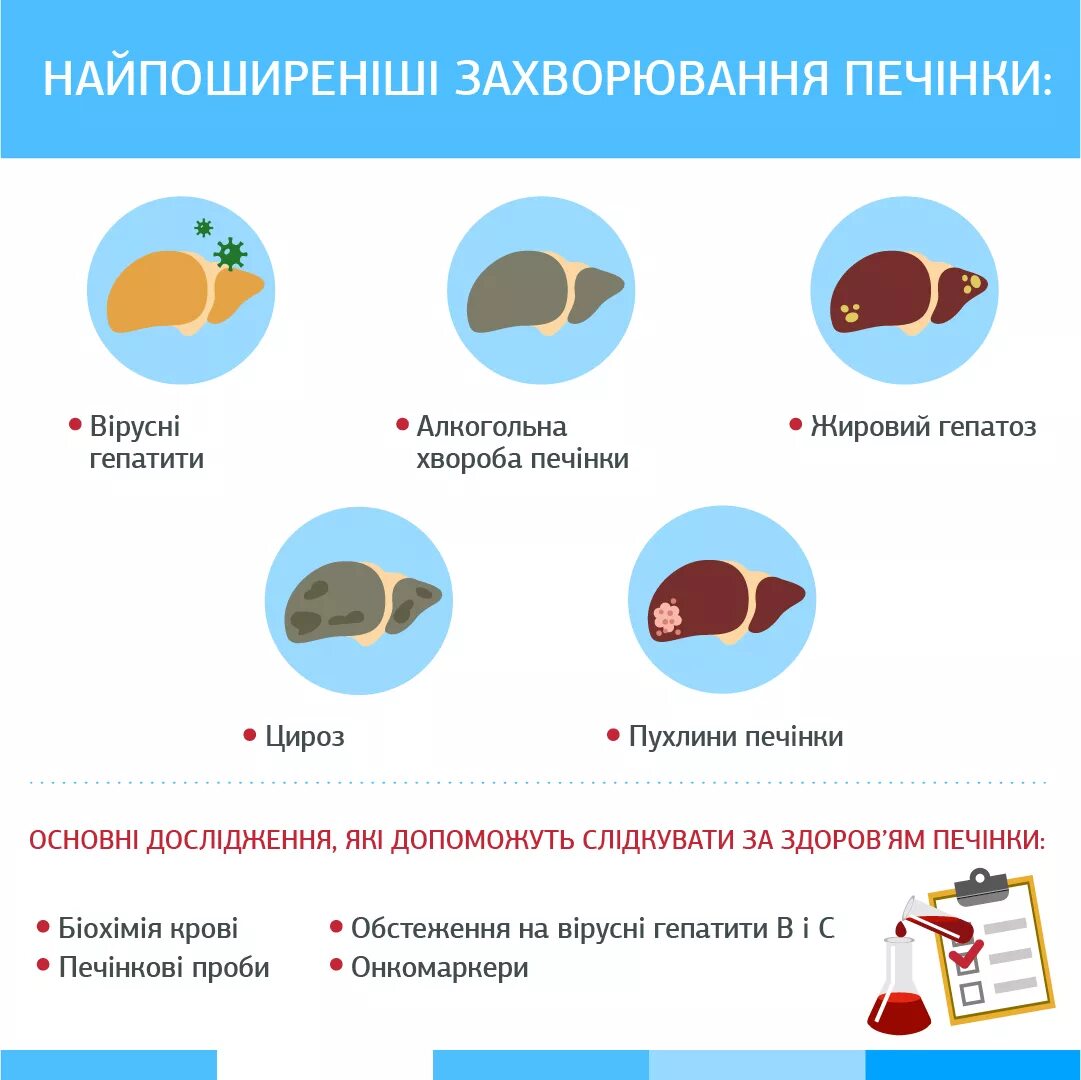 Признаки проблем с печенью. Как понять что больна печень. Если проблема с печенью симптомы. Какие есть болезни печени