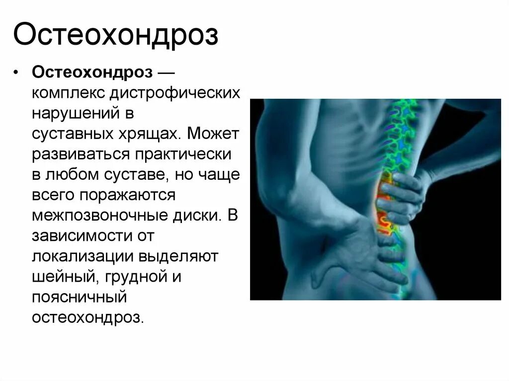 Остеохондроз. Начальный остеохондроз. Остеохондроз позвоночника. Презентация на тему остеохондроз.