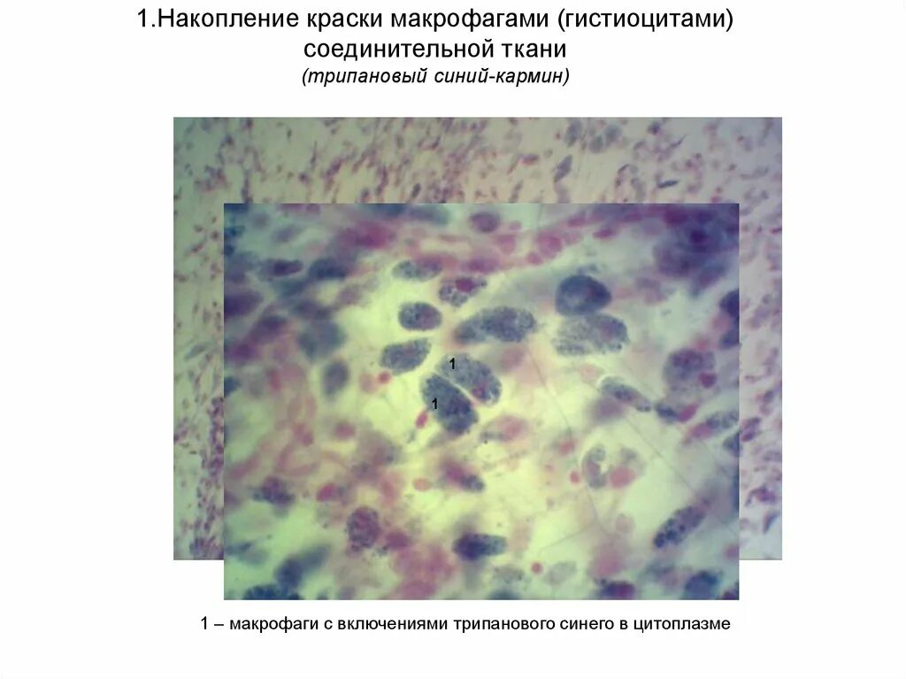 Макрофаги препарат. Гистиоциты подкожной клетчатки крысы. Макрофаги трипановый синий. Макрофаг в рыхлой соединительной ткани. Накопление краски в макрофагах рыхлой соединительной ткани препарат.