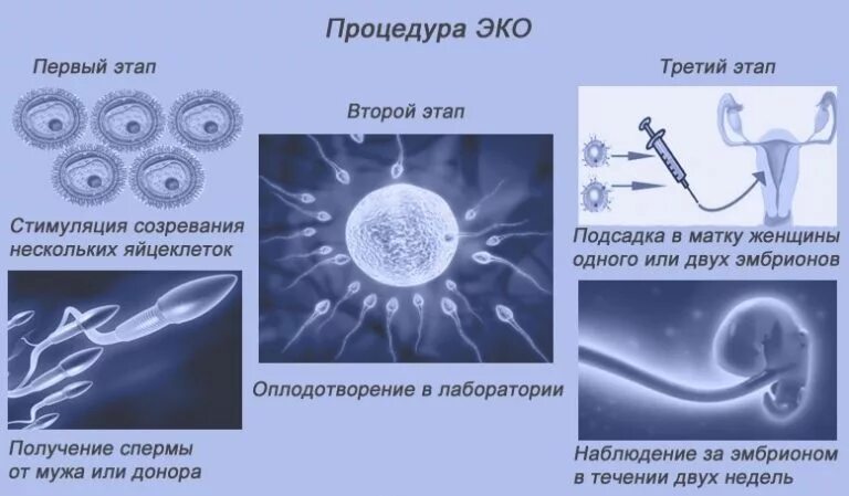 Без труб можно забеременеть естественным. Схема экстракорпорального оплодотворения. Оплодотворение яйцеклетки ИКСИ. Эко метод оплодотворения. Эко оплодотворение яйцеклетки в пробирке.