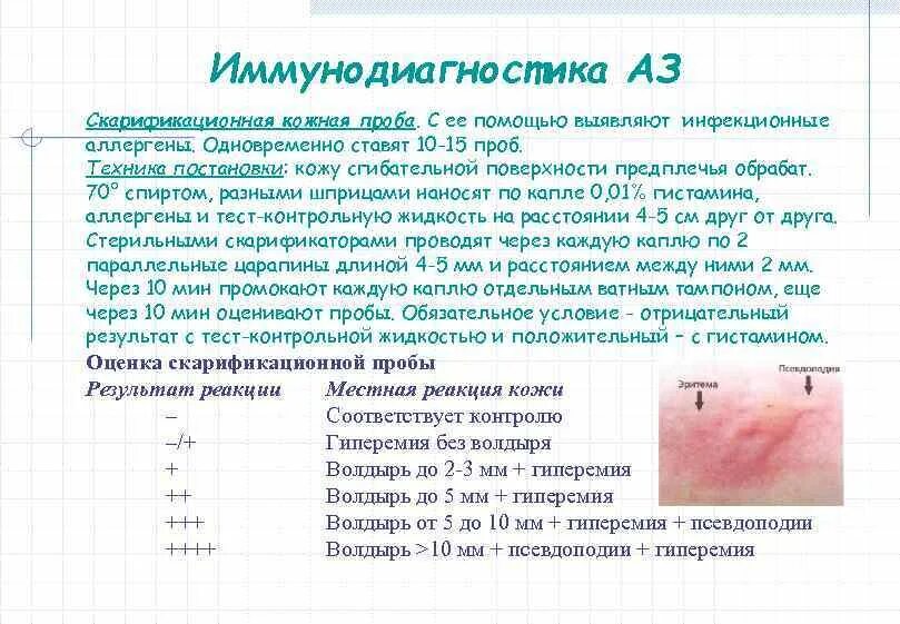 Аллергические реакции тестирование