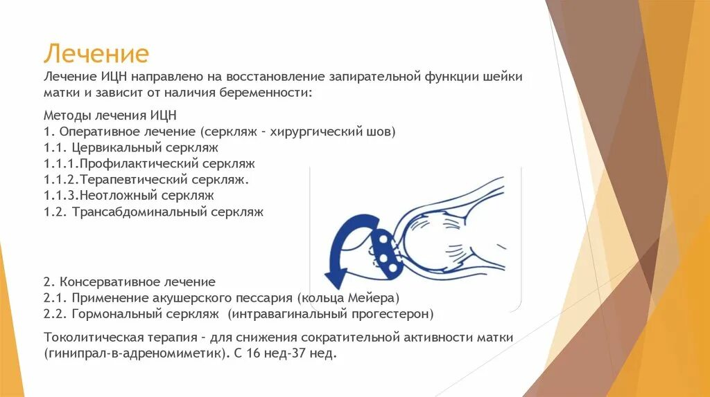 Методы коррекции истмико-цервикальной недостаточности. Классификация ИЦН. Швы при ицн