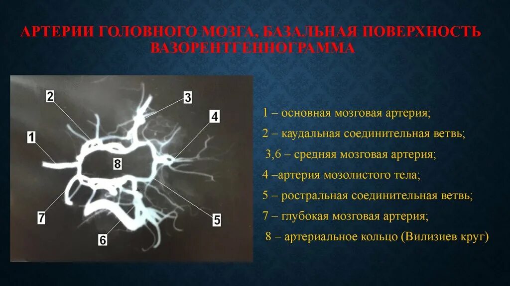 Артерии среднего мозга