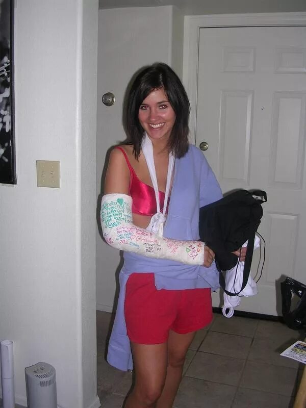 Arm casting. Arm cast. arm cast women. arm cast lac women. plaster cast girl.