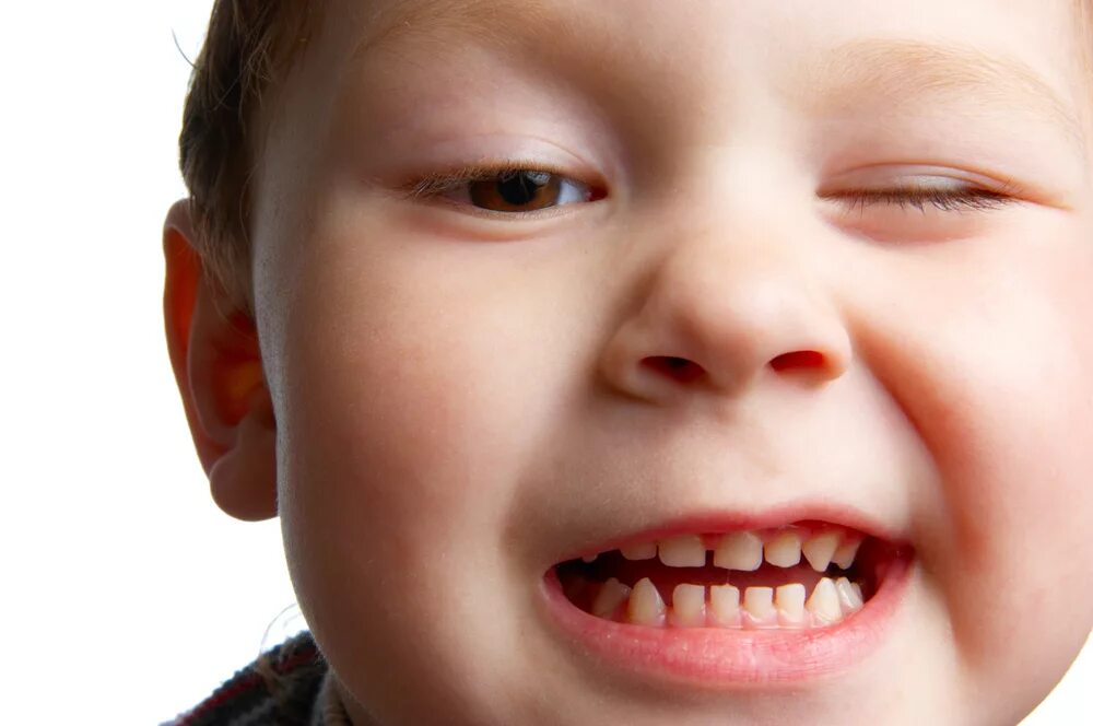 Ребенок год скрежет зубами. Маленькие дети с зубами. Ребенок скоежет зубаси.
