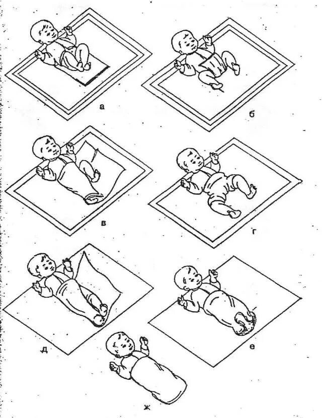 пеленание ребенка алгоритм манипуляции. пеленание новорожденного открытым и закрытым способом алгоритм. пеленание ребенка алгоритм манипуляции. пеленание новорожденного широкое пеленание открытый способ. проведение пеленания новорожденного алгоритм.