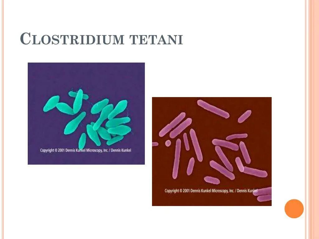 Clostridium spp. Клостридии столбняка микробиология. Бактерией Clostridium tetani.