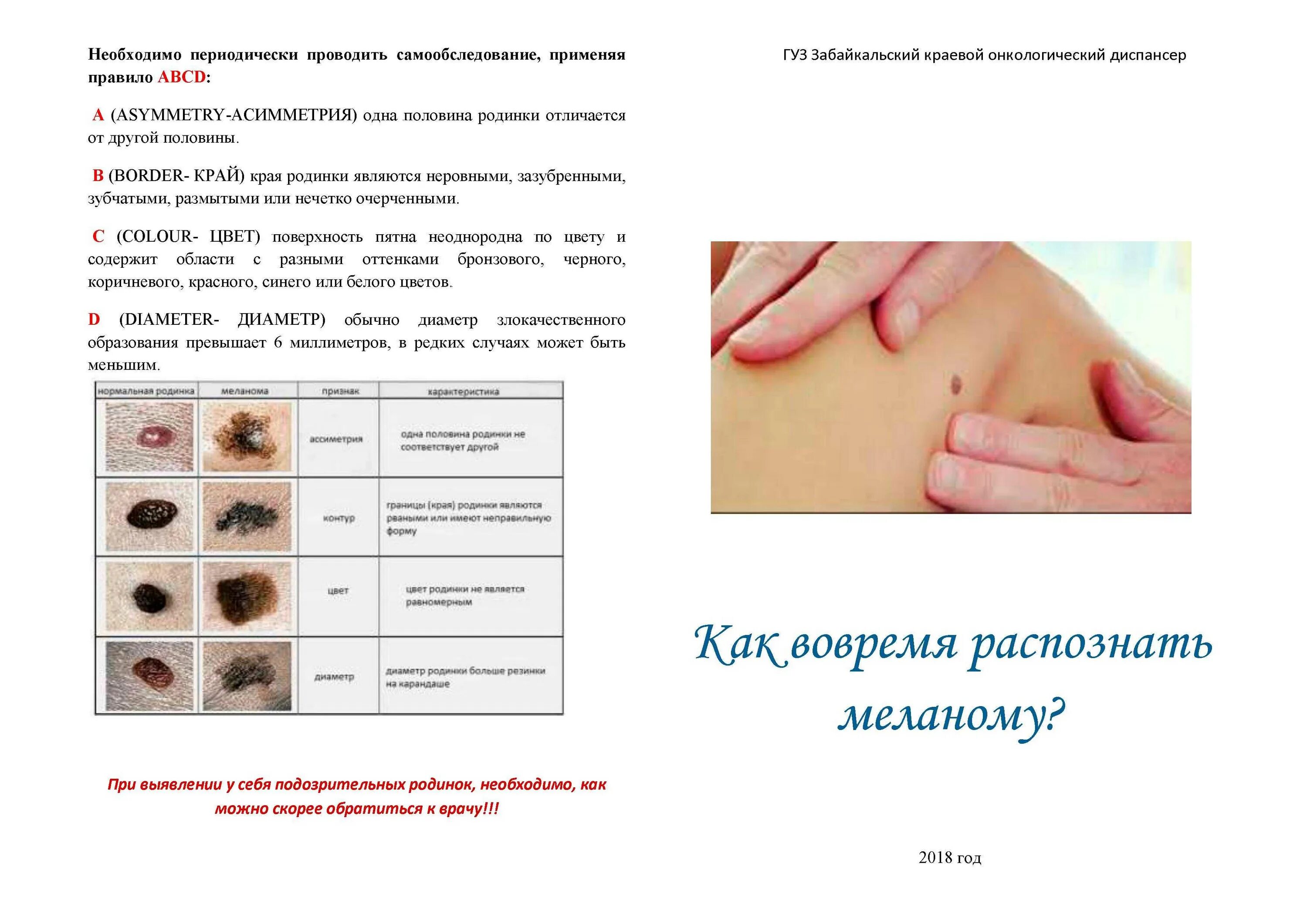 О чем говорит количество родинок. Классификация авсд меланома. Стадии формирования родинки. О чем говорит количество родинок. Новообразования кожи меланома.