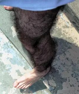 Hairy legs feet