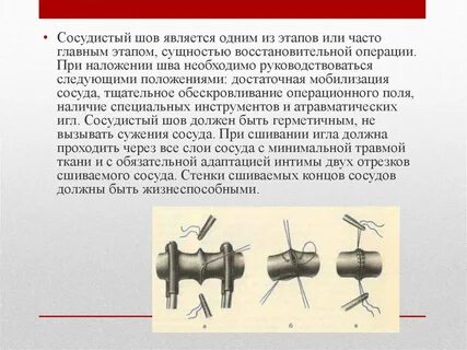 Сшивания двух сосудов
