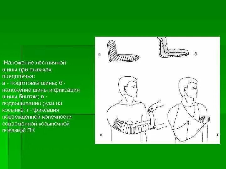 Вывих наложение шины. Вывих наложение шины