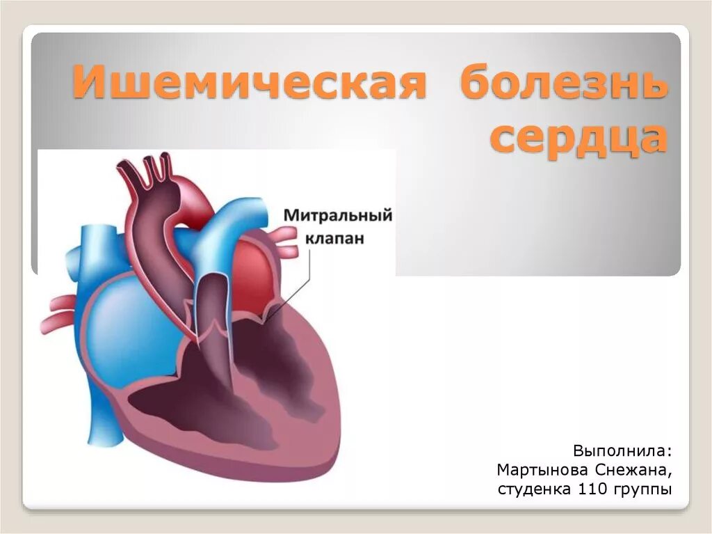 Ишемия отзывы. Ишемическая болезнь сердца презентация.