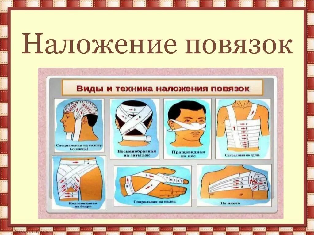 Правила и техника наложения повязок. Шинные повязки виды. Геншин повязка.