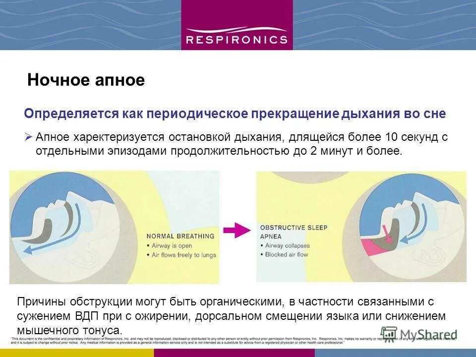 При засыпании останавливается дыхание. Синдром обструктивного апноэ. Обструктивное апноэ сна. Синдром обструктивного апноэ сна.