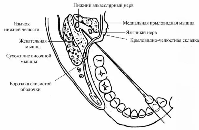 Крылочелюстная складка нижней челюсти. Мандибулярная анестезия в стоматологии схема проведения. Мандибулярная анестезия методика внутриротовые. Мандибулярная анестезия в стоматологии схема. Гоу гейтс