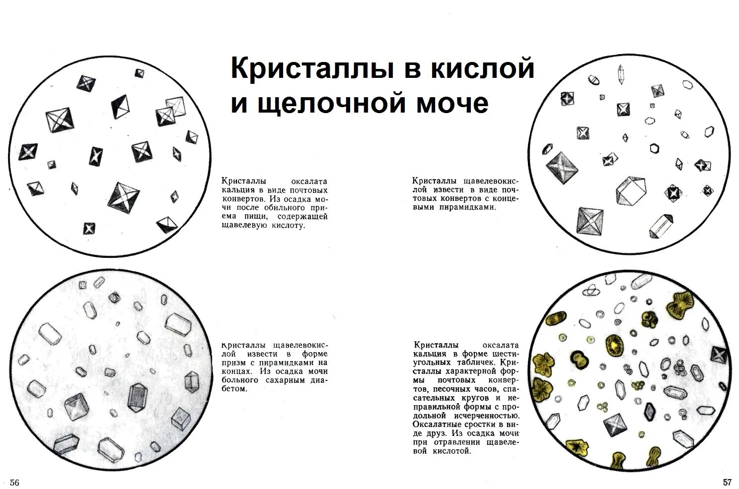 общий анализ мочи соли. большое количество оксалатов причины у женщин. соли оксалаты в моче. кристаллы оксалата кальция показатели в моче. соли в моче у женщины оксалаты.
