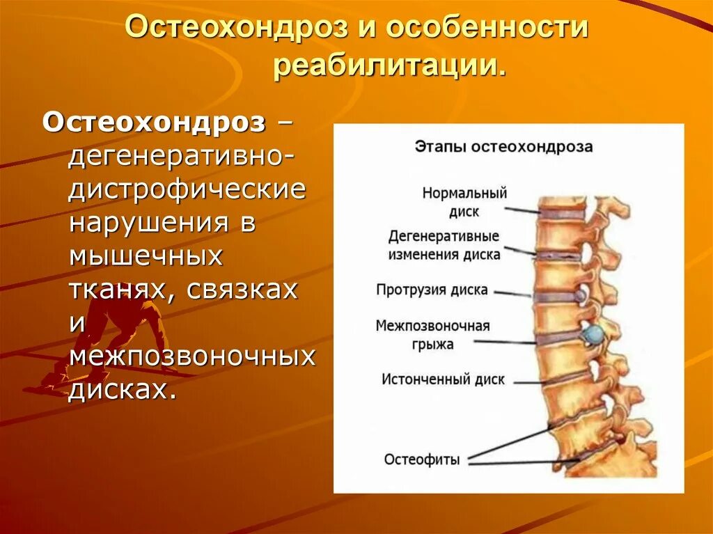 Заболевания отделов позвоночника. Остеохондроз. Заболевания позвоночника остеохондроз. Остеохондроз грудного и поясничного отделов позвоночника. Начальный остеохондроз.