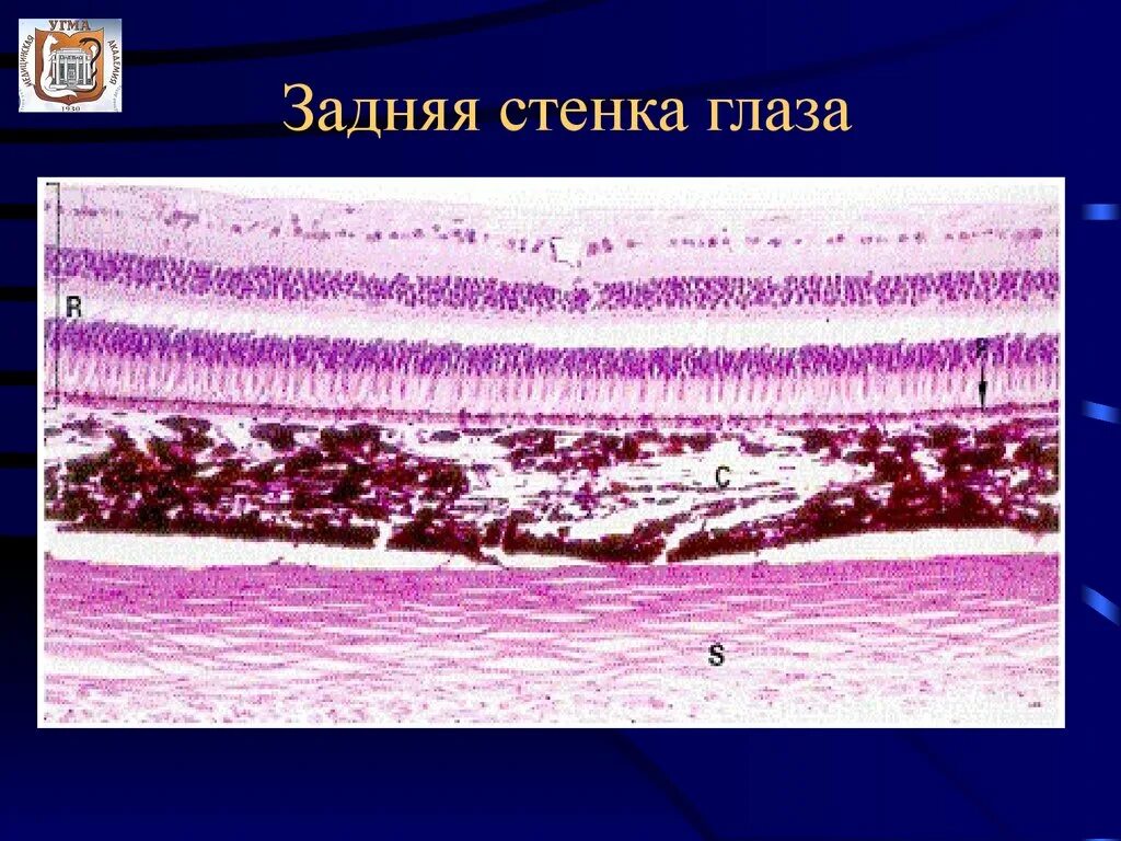 Задняя стенка глаза. Задняя стенка глаза гистология. Задний отдел глаза. Задний отдел глаза препарат гистология.