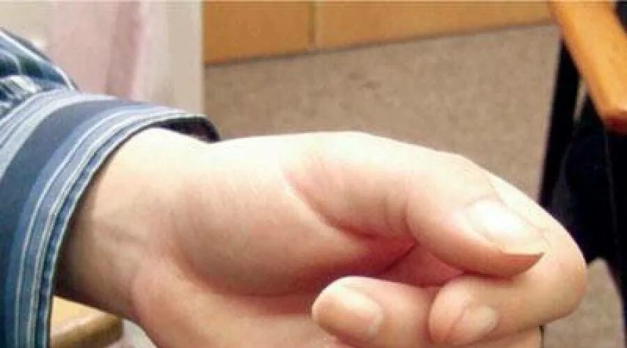 Тремор пальцев. Тремор рук. Трясутся руки причины. Тремор пальцев. Тремор рук причины у подростка.