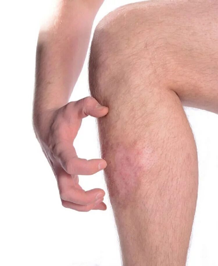 герпес опоясывающий лишай. зуд и боль кожи. зуд и боль кожи. зуд и боль кожи. зуд и боль кожи.