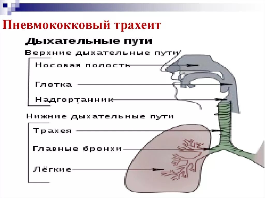 Трахеит эффективное лечение. Трахеит клинические проявления. Воспаление трахеи трахеит. Острый трахеит клиника.