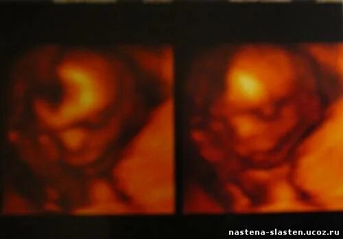 Ребенок в 17 недель фото. Ребенок в 17 недель фото. 17 недель беременности фото плода на узи. Ребёнок на 17 неделе беременности. Ребенок в 17 недель фото.