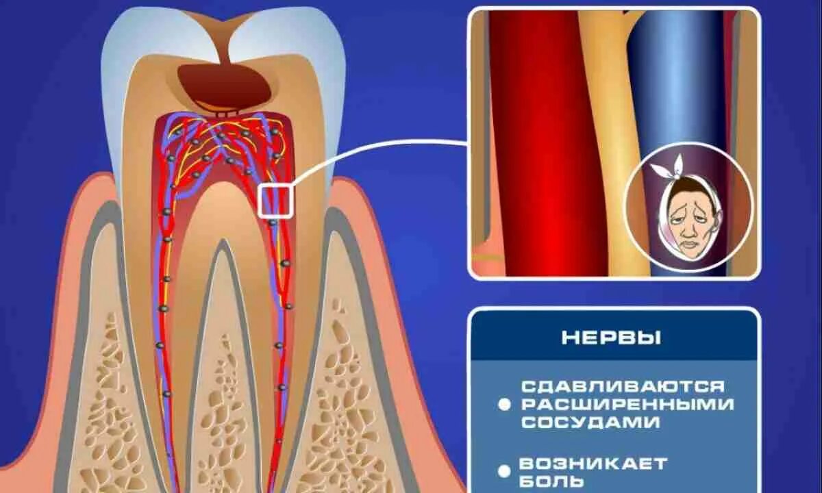 Болит зуб.