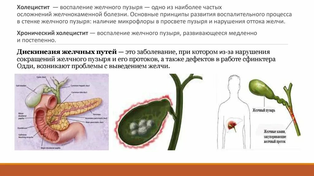 Джвп форум. Дискинезия жёлчного пузыря и желчевыводящих путей. Гепатит холецистит дискинезия ЖВП. Дискинезия желчевыводящих путей и желчного пузыря холецистит.