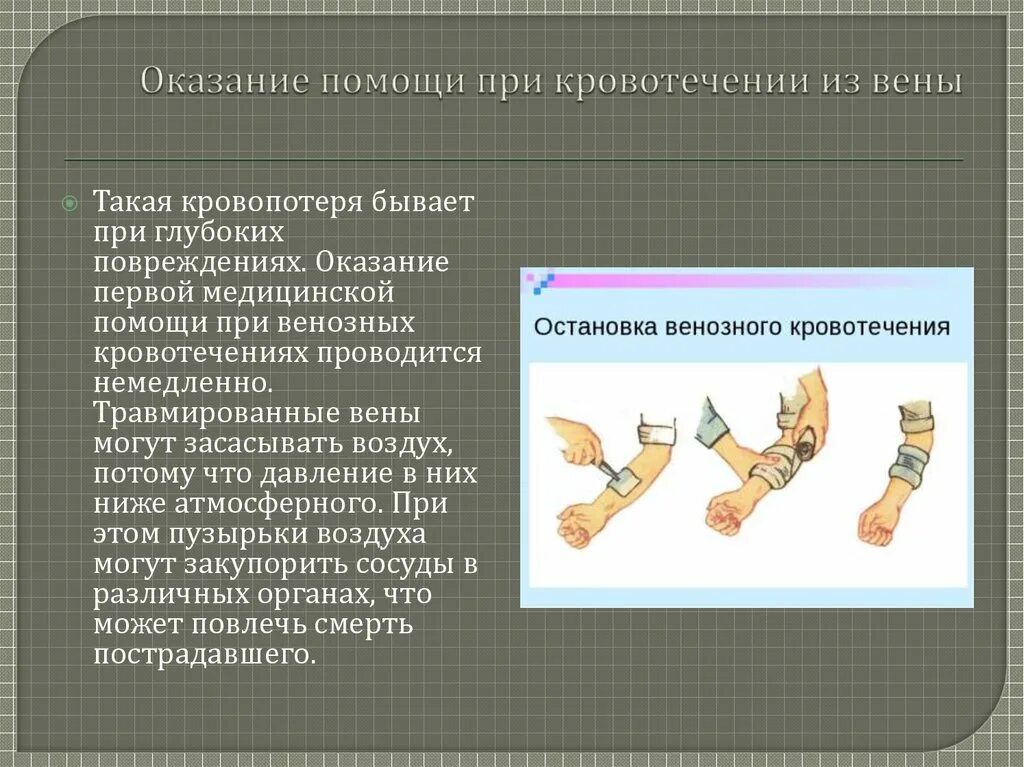 Оказание первой медицинской помощи при ранениях и кровотечениях. Первая помощь при кровотечениях. Оказание 1 помощи при кровотечении.